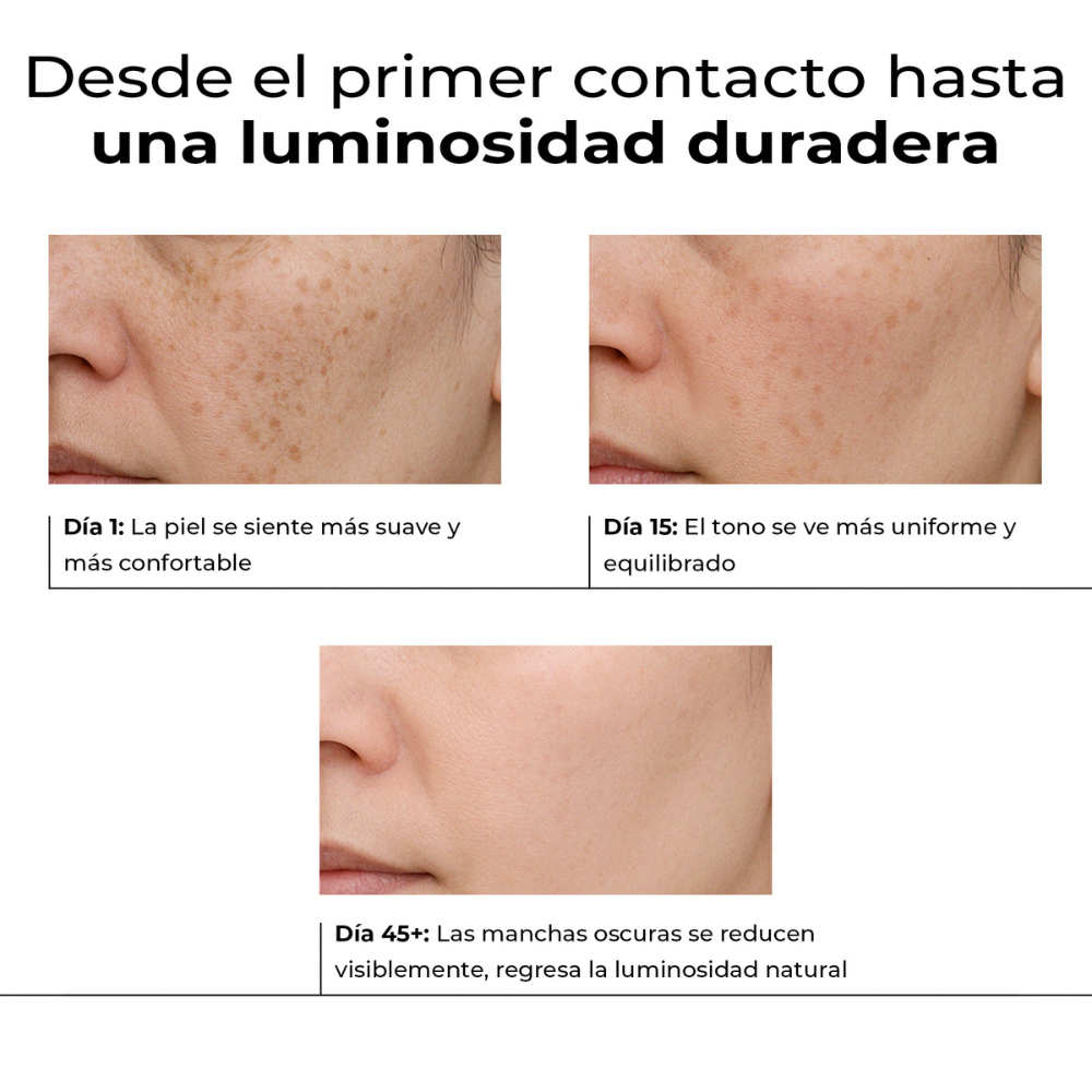 Evolución del sérum Lumen Drop en 45 días – piel más uniforme, sin manchas y visiblemente más luminosa