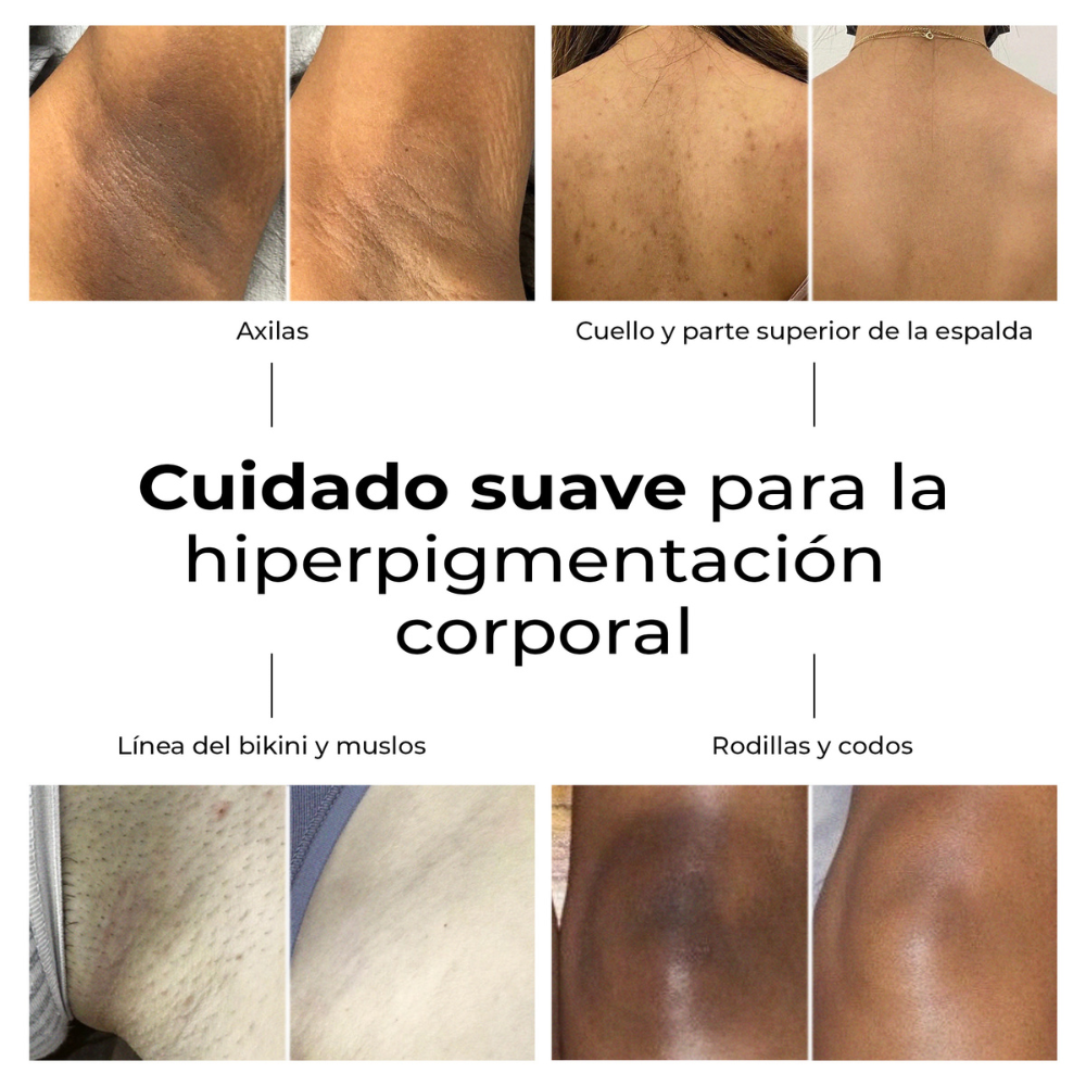 Resultados visibles del sérum Lumen Drop para manchas en axilas, espalda, codos y zona íntima